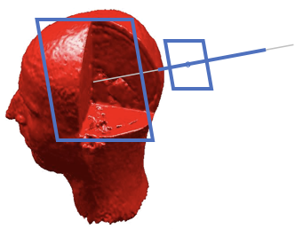 drug delivery to the brain